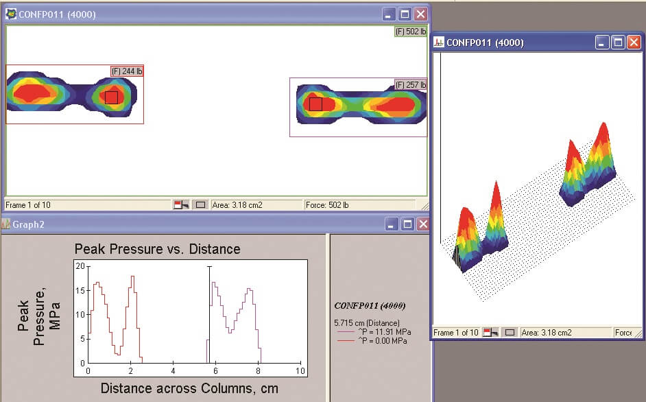 Joint Analysis Software