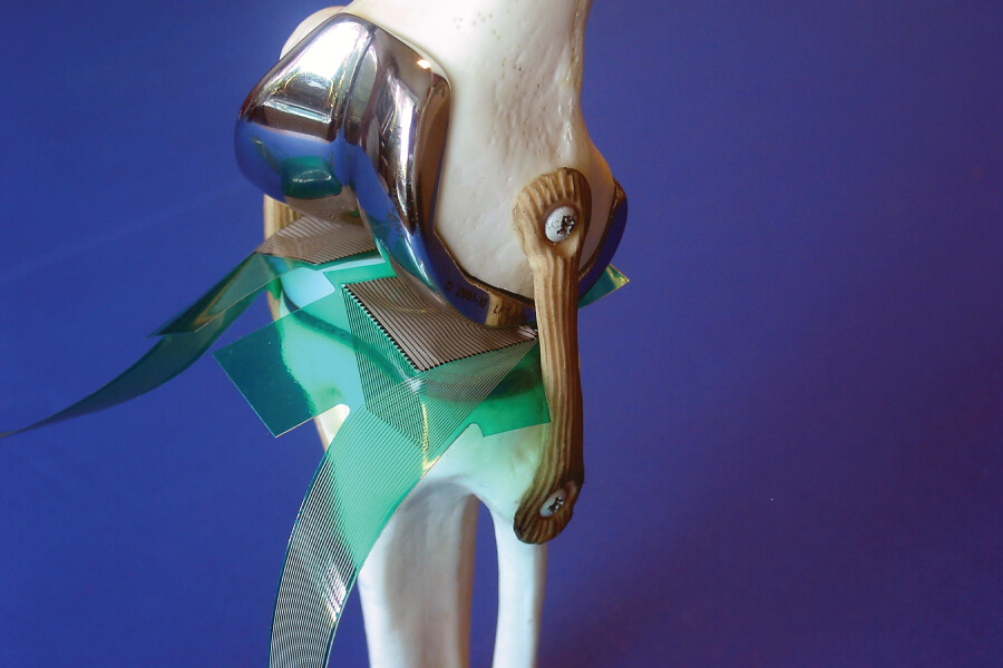 Human Joint Analysis with K-Scan 