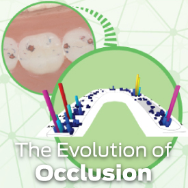 Evolution of Occlusion: A Digital Approach to Overcoming Everyday Challenges Evolution of Occlusion: A Digital Approach to Overcoming Everyday Challenges